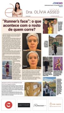  “Runner´s face: o que acontece com o rosto de quem corre?